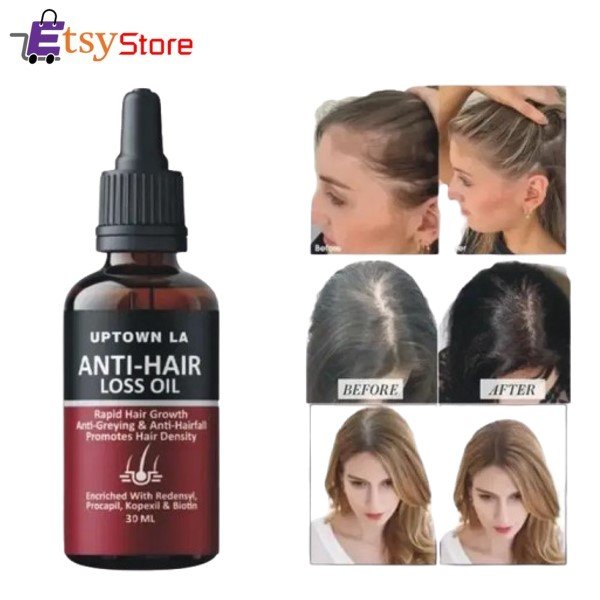 Anti Hair Loss Hair Serum In Pakistan